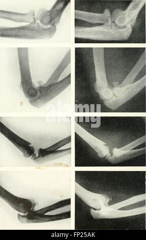 This 1915 work covers advancements in radiography, x-ray therapy, and ...