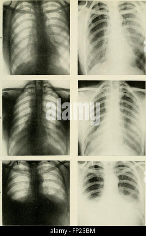 Radiography, x-ray therapeutics and radium therapy (1915) Stock Photo