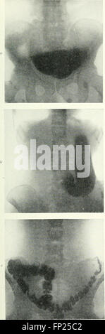 A 1915 publication focusing on the medical applications of radiography ...