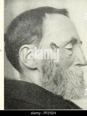 This 1915 work on radiography, X-ray therapeutics, and radium therapy ...