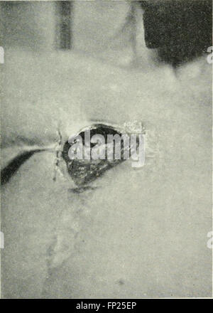 This 1915 work focuses on the use of radiography, X-ray therapy, and ...