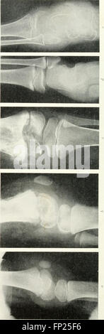 This 1915 publication explores the use of radiography, X-ray therapy ...