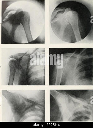 Radiography, X-ray therapeutics and radium therapy (1916) Stock Photo