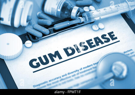 Gum Disease. Medical Concept. Stock Photo