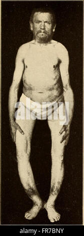 Geriatrics - the diseases of old age and their treatment, including ...