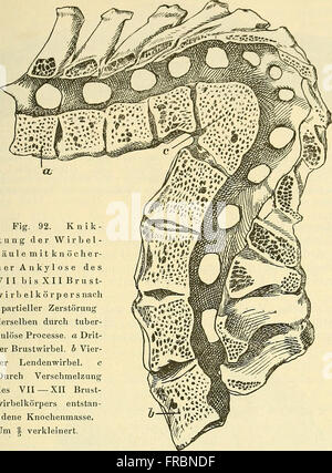 Lehrbuch der allgemeinen pathologischen anatomie und pathogenese (1887 ...