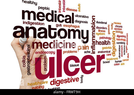 Ulcer word cloud concept Stock Photo