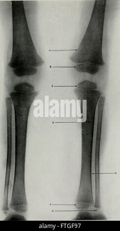 Living anatomy and pathology; the diagnosis of diseases in early life by the Roentgen method (1910) Living anatomy and pathology; the diagnosis of diseases in early life by the Roentgen method (1910)