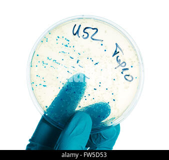 Hand in nitril glove holds Petri dish with bacterial colonies