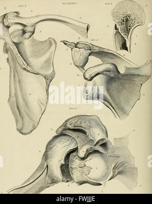 A treatise on dislocations and on fractures of the joints (1824) Stock Photo