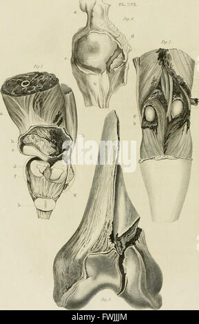 A treatise on dislocations and on fractures of the joints (1824) Stock Photo