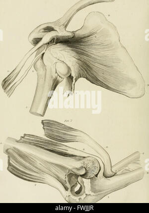 A treatise on dislocations and on fractures of the joints (1824) Stock Photo