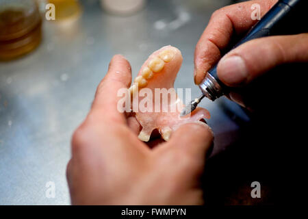 Repairing Artificial Human Teeth Stock Photo