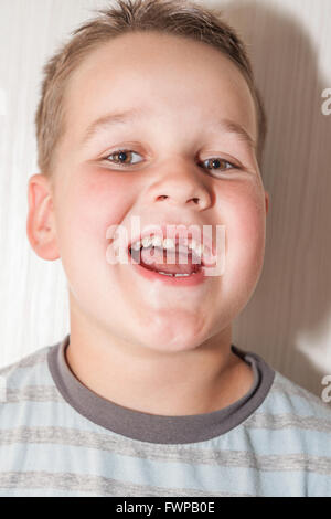 little boy with a torn front first milk tooth Stock Photo