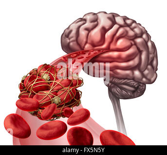 Brain blood clot medical concept as 3D illustration blood cells blocked by an artery blockage thrombus causing a blockage of blood flow to the neurology anatomy. Stock Photo