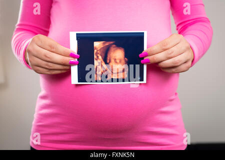 Pregnant woman holds ultrasound photo at the belly Stock Photo