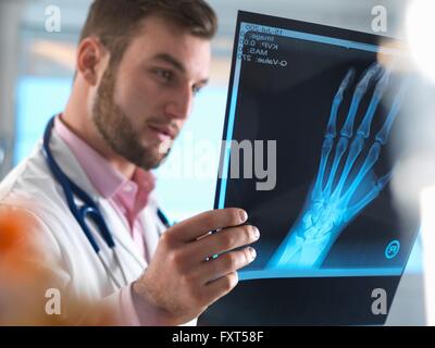 Junior doctor examining x-ray of fractured hand in hospital Stock Photo