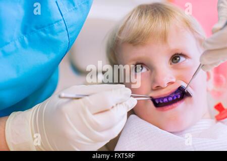dental plaque disclosed