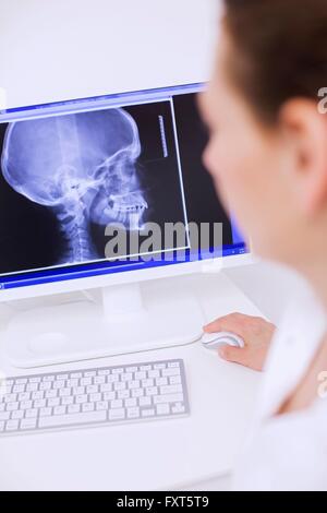 Side view of dentist looking at x-ray image on computer screen Stock Photo
