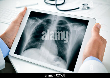 closeup of a young caucasian doctor man sitting at his office desk observing a chest radiograph in a tablet computer Stock Photo