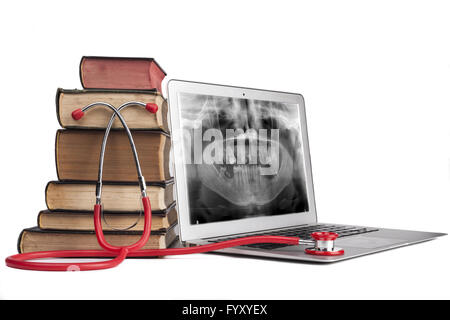 Xray on Laptop Stock Photo