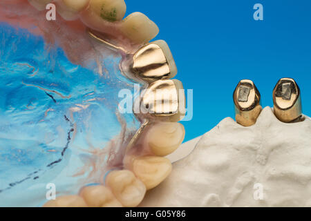 Dentures primary and secondary Stock Photo