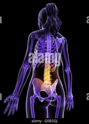 3d rendered illustration of a female having backache Stock Photo