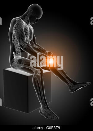 3d rendered medical illustration - painful knee Stock Photo