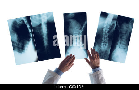 Radiologist checking an x-ray image on a view light box, unrecognizable person, medical assistance and healthcare concept Stock Photo