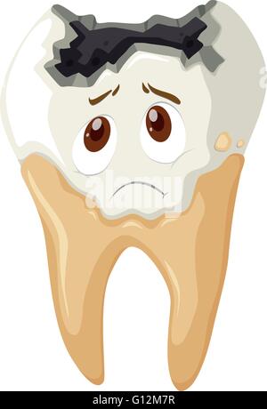 Tooth decay with sad face illustration Stock Vector