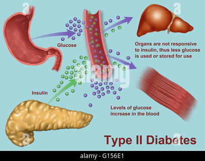 llustration of insulin and glucose production in Type 2 diabetes ...