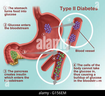 llustration of insulin and glucose production in Type 2 diabetes ...