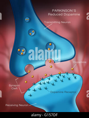 Labeled illustration showing low levels of the neurotransmitter ...