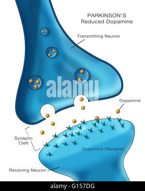 Labeled illustration showing low levels of the neurotransmitter ...