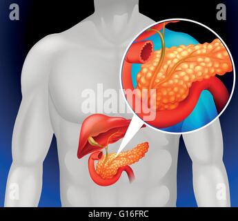 Zoom out human pancreas illustration Stock Vector