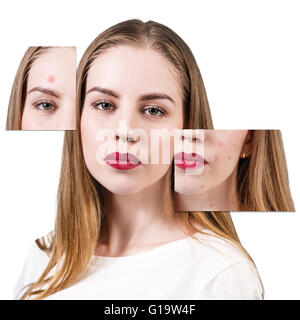 Frames with problem skin on beautiful woman face isolated on white Stock Photo