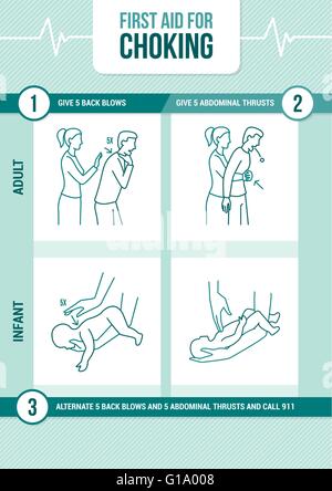 First aid procedure for choking and heimlich maneuver for adults and infants Stock Vector
