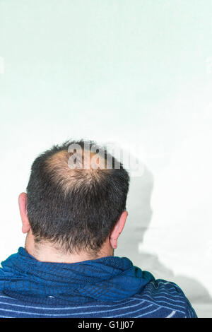 Mature yang man, seen from behind, in the head, begins to lose hair, he begins to be old. Stock Photo