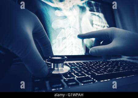 Doctor Xray Imagery Examination on the Laptop Computer. Stock Photo