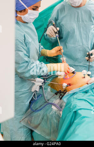 Surgical laparoscopy and hysteroscopy exploration here, treatment of endometriosis, Limoges hospital, France. Stock Photo