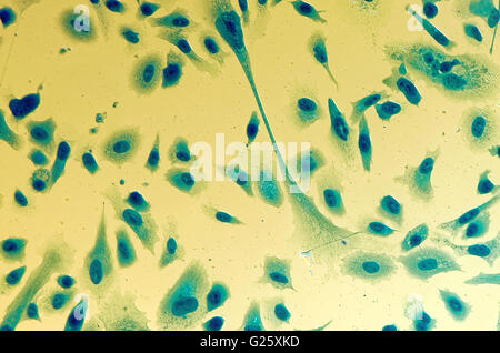 PC-3 human prostate cancer cells, stained with Coomassie blue, under ...