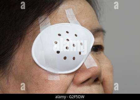 eye shield surgery cataract after covering surgical plastic alamy woman patch senior