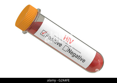 test tube with sample blood positive HIV virus. 3D rendering isolated on white background
