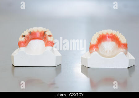 Upper and Lower False Teeth Stock Photo