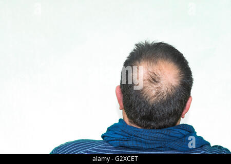 Mature yang man, seen from behind, in the head, begins to lose hair, he begins to be old. Stock Photo