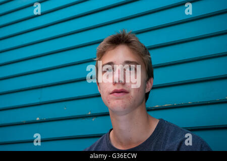 teenage boy with acne Stock Photo