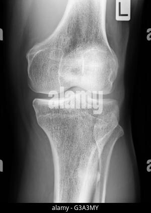 Anatomy of human knee joint Stock Photo - Alamy