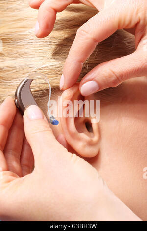 Hearing impairment, hearing aid selection. Stock Photo