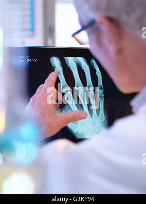Radiographer looking at x-ray of hand fracture Stock Photo