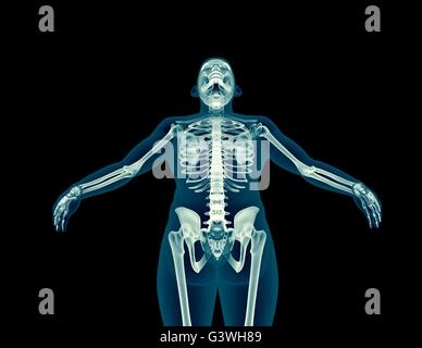 An X-ray of a human body Stock Photo - Alamy
